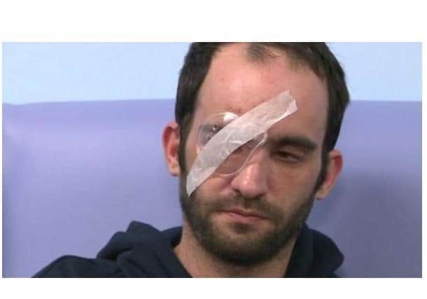 Marc Toone has been left blinded in one eye after the attack.